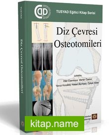 Diz Çevresi Osteotomileri